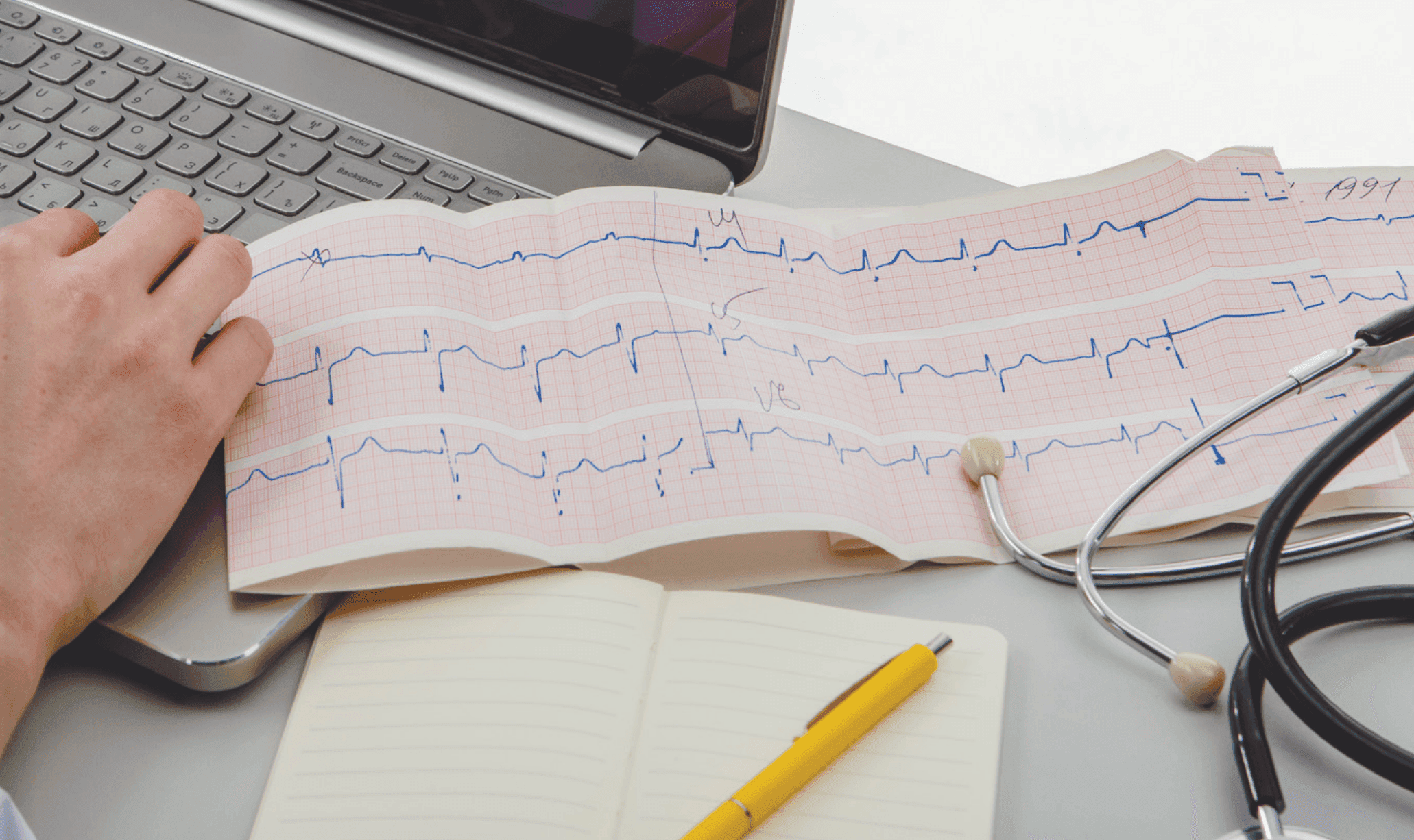 Результаты исследования АВАНГАРД